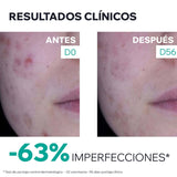 Crema Anti-Imperfecciones Hyséac 3-Regul+ 40Ml Uriage